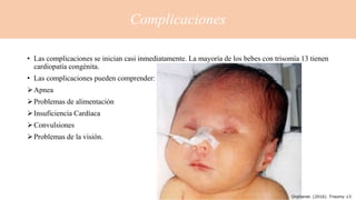 Complicaciones
• Las complicaciones se inician casi inmediatamente. La mayoría de los bebes con trisomía 13 tienen
cardiopatía congénita.
• Las complicaciones pueden comprender:
Apnea
Problemas de alimentación
Insuficiencia Cardíaca
Convulsiones
Problemas de la visión.
Orphanet. (2016). Trisomy 13.
 