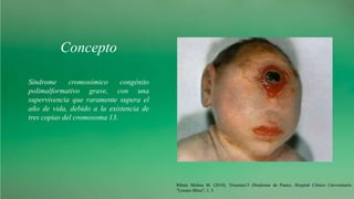 Concepto
Ribate Molina M. (2010). Trisomía13 (Síndrome de Patau). Hospital Clínico Universitario
"Lozano Blesa", 1, 5.
Síndrome cromosómico congénito
polimalformativo grave, con una
supervivencia que raramente supera el
año de vida, debido a la existencia de
tres copias del cromosoma 13.
 