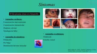 Síntomas
• Anomalías cardíacas:
Comunicación interventricular
Comunicación interauricular
Displasia valvular
Tetralogía de fallot
• Anomalías de miembros:
Polidactilia
Pie Valgo
Disminución del tono muscular
• Anomalías en abdomen:
Onfalocele
Extrofia vesical
El feto presenta retraso en el desarrollo:
Ribate Molina M. (2010). Trisomía13 (Síndrome de Patau).
Hospital Clínico Universitario "Lozano Blesa", 1, 5.
 