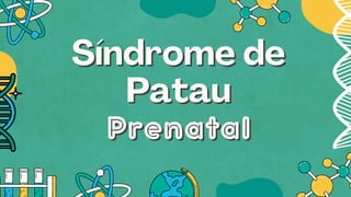 Síndrome de
Síndrome de
Patau
Patau
Prenatal
Prenatal
 