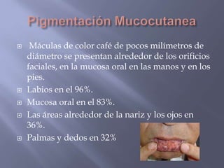 Pigmentación Mucocutanea Máculas de color café de pocos milímetros de diámetro se presentan alrededor de los orificios faciales, en la mucosa oral en las manos y en los pies. Labios en el 96%.Mucosa oral en el 83%. Las áreas alrededor de la nariz y los ojos en 36%. Palmas y dedos en 32% 