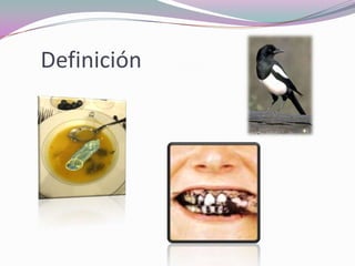 Definición