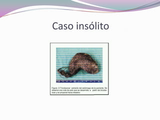 Caso insólito
