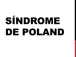 SÍNDROME
DE POLAND
 