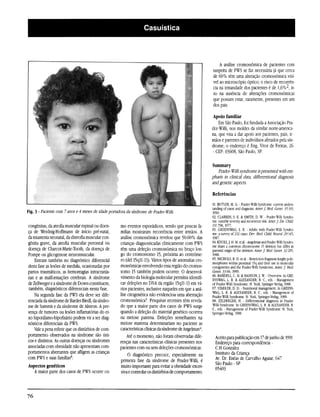 A análise cromossômica de pacientes com
                                                                                                         suspeita de PWS se faz necessária já que cerca
                                                                                                         de 60% têm uma alteração cromossômica visí-
                                                                                                         vel ao microscópio óptico; o risco de recorrên-
                                                                                                         cia na irmandade dos pacientes é de 1,6%2, is-
                                                                                                         so na ausência de alterações cromossômicas
                                                                                                         que possam estar, raramente, presentes em um
                                                                                                         dos pais.

                                                                                                         Apoio familiar
                                                                                                             Em São Paulo, foi fundada a Associação Pra-
                                                                                                         der-Willi, nos moldes da similar norte-america-
                                                                                                         na, que visa a dar apoio aos pacientes, pais, ir-
                                                                                                         mãos e parentes de indivíduos afetados pela sín-
                                                                                                         drome; o endereço é Eng. Vítor de Freitas, 26
                                                                                                          - CEP: 03608, São Paulo, SP.

                                                                                                         Summary
                                                                                                            Prader-Willi syndrome is presented with em-
                                                                                                         phasis in clinical data, differentional diagnosis
                                                                                                         and genetic aspects.

                                                                                                         Referências

                                                                                                         01. BUTLER, M. G. - Prader-Willi Syndrome: current unders-
                                                                                                         tanding of cause and diagnosis. Amer.J. Med. Genet. 35/319,
                                                                                                         1990.
                                                                                                         02. CLARREN, S. K. & SMITH, D. W. - Prader-Willi Syndro-
                                                                                                         me: variable severity and recurrence risk. Amer.J. Dis. Child
congênitas, da atrofia muscular espinal ou doen-    mo eventos esporádicos, sendo que poucas fa-         131:198, 1977.
ça de Werdnig-Hoffmann de início pré-natal,                                                              03. GREENSWAG, L. R. - Adults with Prader-Willi Syndro-
                                                    mílias mostraram recorrência entre irmãos. A         me: a survey of 232 cases. Dev. Med. Child. Neurol. 2^/145,
da miastenia neonatal, da distrofia muscular con-   análise cromossômica revelou que 50-60% das          1987.
gênita grave, da atrofia muscular peroneal ou       crianças diagnosticadas clinicamente com PWS         04. KNOLL,]. H. M. etal. -Angelman and Prader-Willi Syndro-
                                                                                                         me share a common chromosome 15 deletion but differ in
doença de Charcot-Marie-Tooth, da doença de         têm uma deleção cromossômica no braço lon-           parental origin of the deletion. Amer.J. Med. Genet. 32:285,
Pompe ou glicogenose neuromuscular.                 go do cromossomo 15, próxima ao centrôme-            1988.
    Entram também no diagnóstico diferencial        ro (dei 15qlH3). Vários tipos de anomalias cro-      05. NICHOLS, R. D. et al. - Restriction fragment lenght poly-
                                                                                                         morphisms within proximal 15q and their use in molecular
desta fase as lesões de medula, ocasionadas por     mossômicas envolvendo essa região do cromos-         cytogenetics and the Prader-Willi Syndrome. Amer.J. Med.
partos traumáticos, as hemorragias intracrania-     somo 15 também podem ocorrer. O desenvol-            Genet. 33/66, 1989.
nas e as malformações cerebrais. A síndrome         vimento da biologia molecular permitiu identifi-     06. RANDELL, C. H. & HANSON, J. W. - Overview. In GRE-
                                                                                                         ENSWAG, L. R. & ALEXANDER, R. C., eds. - Management
de Zellweger e a síndrome de Down constituem,       car deleções no DNA da região 15qll-13 em vá-        of Prader-Willi Syndrome. N. York, Springer-Verlag, 1988.
também, diagnósticos diferenciais nesta fase.       rios pacientes, inclusive naqueles em que a aná-     07. STABLER, D. D. - Nutritional management. In GREENS-
                                                                                                         WAG, L. R. & ALEXANDER, R. C., eds. - Management of
    Na segunda fase da PWS ela deve ser dife-       lise citogenética não evidenciou uma aberração       Prader-Willi Syndrome. N. York, Springer-Verlag, 1988.
renciada da síndrome de Bardet-Biedl, da síndro-    cromossômica5. Pesquisas recentes têm revela-        08. ZELLWEGER, H. - Differentional diagnosis in Prader-
me de Summit e da síndrome de Alstron. A pre-       do que a maior parte dos casos de PWS surge          Willi Syndrome. In GREENSWAG, L. R. & ALEXANDER, R.
                                                                                                         C., eds. - Management of Prader-Willi Syndrome. N. York,
sença de tumores ou lesões inflamatorias do ei-     quando a deleção do material genético ocorreu        Springer-Verlag, 1988.
xo hipotálamo-hipofisário podem vir a ser diag-     na meiose paterna. Deleções semelhantes na
nósticos diferenciais da PWS.                       meiose materna determinariam no paciente as
    Vale a pena referir que os distúrbios de com-   características clínicas da síndrome de Angelman4.
portamento observados na síndrome são úni-               Até o momento, não foram observadas dife-         Aceito para publicação em 17 de junho de 1991
cos e distintos. As outras doenças ou síndromes     renças nas características clínicas presentes nos      Endereço para correspondencia -
associadas com obesidade não apresentam com-        pacientes com ou sem deleções cromossômicas.           C.H.Gonzalez
portamentos aberrantes que afligem as crianças                                                             Instituto da Criança
                                                         O diagnóstico precoce, especialmente na
com PWS e suas famílias8.                            primeira fase da síndrome de Prader-Willi, é          Av. Dr. Enéas de Carvalho Aguiar, 647
Aspectos genéticos                                   muito importante para evitar a obesidade exces-       São Paulo - SP
   A maior parte dos casos de PWS ocorre co-                                                               05403
                                                     siva e controlar os distúrbios de comportamento.
 