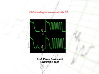 Eletrocardiograma e o Intervalo QT Prof. Paulo Cavalcanti UNIFENAS 2009 