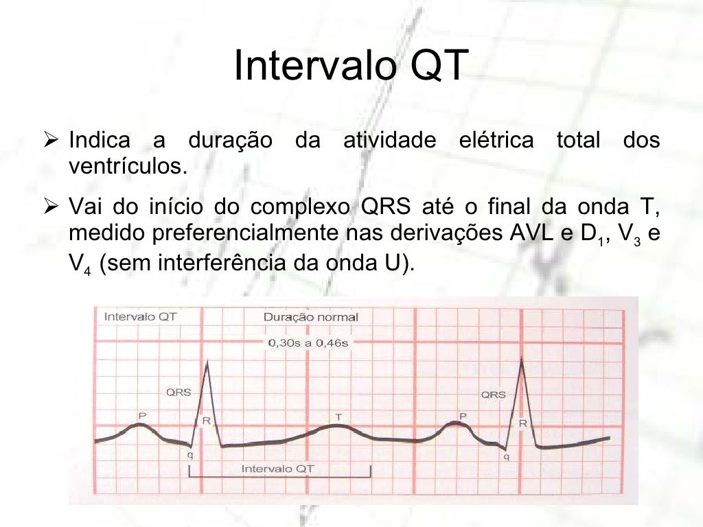 SÍNDROME DO QT LONGO