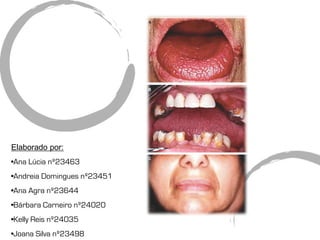 Elaborado por:
•Ana Lúcia nº23463
•Andreia Domingues nº23451
•Ana Agra nº23644
•Bárbara Carneiro nº24020
•Kelly Reis nº24035
•Joana Silva nº23498
 