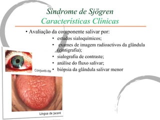 Síndrome de Sjögren
      Características Clínicas
• Avaliação da componente salivar por:
            • estudos sialoquímicos;
            • exames de imagem radioactivos da glândula
              (cintigrafia);
            • sialografia de contraste;
            • análise do fluxo salivar;
            • biópsia da glândula salivar menor
 