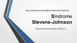 Síndrome
Stevens-Johnson
Yeiscimin Sánchez Escobedo. 201201713.
REACCIONES ADVERSAS MEDICAMENTOSAS GRAVES:
 