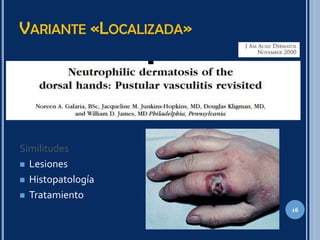 VARIANTE «LOCALIZADA»
Similitudes
 Lesiones
 Histopatología
 Tratamiento
16
 