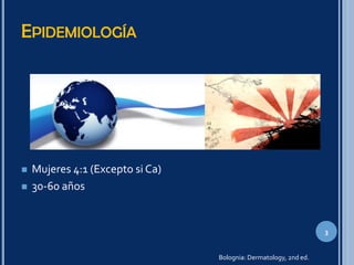 EPIDEMIOLOGÍA
 Mujeres 4:1 (Excepto si Ca)
 30-60 años
3
Bolognia: Dermatology, 2nd ed.
 