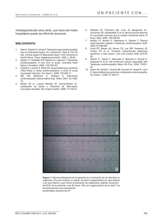 Dolor torácico y ascenso del... Córdoba JG, et al.
                                                                                       UN PACIENTE CON...



infradiagnosticado años atrás, que fuera del medio                         6.  Wittstein IS, Thiemann DR, Lima JA, Baughman KL,
hospitalario puede ser difícil de reconocer.                                   Schulman SP, Gerstenblith G et al. Neurohumoral features
                                                                               of myocardial stunning due to sudden emotional stress. N
                                                                               Engl J Med. 2005; 352:539-48.
                                                                           7. Akashi YJ, Musha H, Nakazawa K, Miyake F. Plasma
BIBLIOGRAFÍA                                                                   brainnatriuretic peptide in takotsubo cardiomyopathy. QJM.
                                                                               2004; 97:599-607.
1.   Sato H, Tateishi H, Uchida T. Takotsubo-type cardiomyopathy           8. Hurst RT, Askew JW, Reuss CS, Lee RW, Sweeney JP,
     due to multivessel spasm. En: Kodama K, Haze K, Hon M,                    Fortuin FD et al. Transient midventricular ballooning
     eds. Clinical aspect of Myocardial injury: From Ischemia to               syndrome: a new variant. J Am Coll Cardiol. 2006; 48:579-
     Heart Failure. Tokyo: Kagakuhyouronsha; 1990. p. 56-64.                   83.
2.   Akashi YJ, Goldstein DS, Barbaro G, Ueyama T. Takotsubo               9. Akashi YJ, Tejima T, Sakurada H, Matsuda H, Suzuki K,
     Cardiomyopathy: A new form of acute, reversible heart                     Kawasaki K et al. Left ventricular rupture associated with
     failure. Circulation. 2008; 118:2754-62.                                  Takotsubo cardiomyopathy. Mayo Clin Proc. 2004; 79:821-
3.   Prasad A, Lerman A, Rihal CS. Apical ballooning syndrome                  24.
     (Tako-Tsubo or stress cardiomyopathy): a mimic of acute               10. Gianni M, Dentali F, Grandi AM, Sumner G, Hiralal R, Lonn
     myocardial infarction. Am Heart J. 2008; 155:408-17.                      E. Apical ballooning syndrome or takotsubo cardiomyopathy.
4.   Nef HM, Möllmann H, Elsässer A. Tako-tsubo                                Eur Heart J. 2006; 27:2907-8.
     cardiomyopathy (Apical ballooning). Heart. 2007; 93:1309-
     15.
5.   Núñez Gil IJ, Luaces Méndez M, García-Rubira JC.
     Cardiopatía de estrés o Síndrome de Tako-tsubo:
     Conceptos Actuales. Rev Argent Cardiol. 2009; 77:218-23.




                                Figura 1. Electrocardiograma de la paciente en el momento de ser atendida en
                                urgencias (1A) que muestra un patrón de lesión subepicárdica en cara anterior
                                y en cara inferior y que motivó la indicación de cateterismo urgente. Evolución
                                del ECG de la paciente a las 48 horas (1B) con negativización de la onda T en
                                las derivaciones que previamente
                                presentaban ascenso del ST.




REV CLÍN MED FAM 2011; 4 (3): 259-263                                                                                                262
 