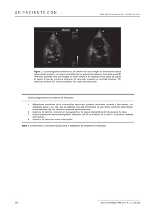 UN PACIENTE CON...                                                                         Dolor torácico y ascenso del... Córdoba JG, et al.




                  Figura 2. Ecocardiograma transtorácico. Se observa la típica imagen de balonización apical
                  del ventrículo izquierdo por hipercontractilidad de los segmentos basales y discinesia apical. El
                  ventrículo izquierdo toma una imagen en jarrón, similar a los utilizados en la pesca de pulpos
                  en Japón, lo que dio nombre al síndrome. VI: ventrículo izquierdo, AI: aurícula Izquierda, VD:
                  ventrículo derecho, AD: aurícula derecha, SIV: septo Interventricular.




            Criterios diagnósticos de Síndrome de Takotsubo


            1.   Alteraciones transitorias de la contractilidad ventricular izquierda (discinesia, acinesia o hipocinesia), con
                 afectación apical o sin ella, que se extiende más allá del territorio de una arteria coronaria determinada;
                 ocasionalmente hay una situación estresante desencadenante.
            2.
            3.
                 de troponina.
            4.   Ausencia de Feocromocitoma o Miocarditis.


      Tabla 1. Criterios de la Clínica Mayo (2008) para el diagnóstico de Síndrome de Takotsubo.




263                                                                                         REV CLÍN MED FAM 2011; 4 (3): 259-263
 