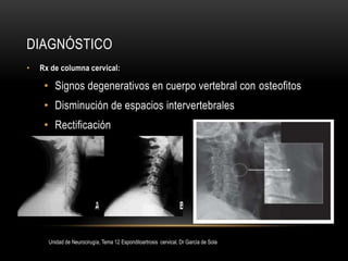 DIAGNÓSTICO
• Rx de columna cervical:
• Signos degenerativos en cuerpo vertebral con osteofitos
• Disminución de espacios ...