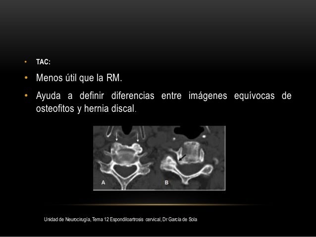 Por qué bolyat los pies a la osteocondrosis