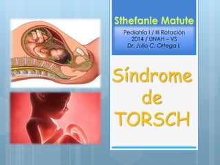 Síndrome
de
TORSCH
Pediatría I / III Rotación
2014 / UNAH – VS
Dr. Julio C. Ortega I.
 