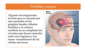 Posibles causas

Algunas investigaciones
revelan que es causado por
una anomalía en los
ganglios basales, lóbulos
frontales y la corteza
cerebral; no se completan los
circuitos que hacen conexión
entre esas regiones y los
neuro -transmisores de las
células nerviosas
 