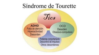 Síndrome de Tourette
 