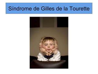 Síndrome de Gilles de la Tourette
 