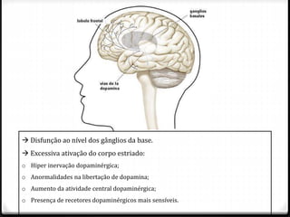  Disfunção ao nível dos gânglios da base.
 Excessiva ativação do corpo estriado:
o Hiper inervação dopaminérgica;
o Anormalidades na libertação de dopamina;
o Aumento da atividade central dopaminérgica;
o Presença de recetores dopaminérgicos mais sensíveis.
 