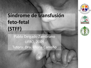Síndrome de transfusión feto-fetal (STFF) Pablo Delgado Zambrano UFRO, 2009 Tutora: Dra. Gloria Carreño 