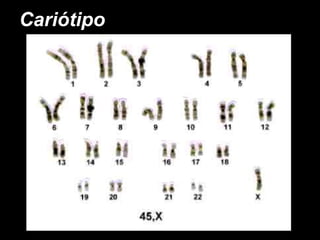 Cariótipo 