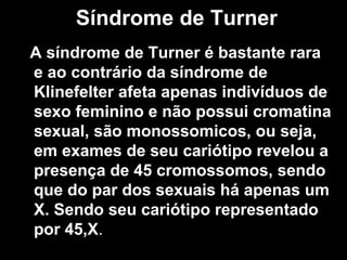 Síndrome de Turner ,[object Object]