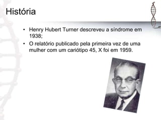 História
• Henry Hubert Turner descreveu a síndrome em
1938;
• O relatório publicado pela primeira vez de uma
mulher com um cariótipo 45, X foi em 1959.

 