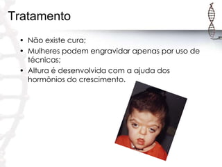 Tratamento
• Não existe cura;
• Mulheres podem engravidar apenas por uso de
técnicas;
• Altura é desenvolvida com a ajuda dos
hormônios do crescimento.

 
