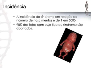 Incidência
• A incidência da síndrome em relação ao
número de nascimentos é de 1 em 5000;
• 98% dos fetos com esse tipo de síndrome são
abortados.

 