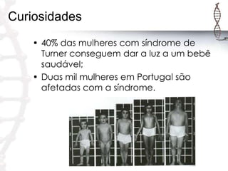 Curiosidades
• 40% das mulheres com síndrome de
Turner conseguem dar a luz a um bebê
saudável;
• Duas mil mulheres em Portugal são
afetadas com a síndrome.

 