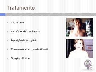 Tratamento


Não há cura;



Hormônios de crescimento



Reposição de estrogênio



Técnicas modernas para fertilização



Cirurgias plásticas

 