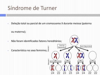 Síndrome de Turner


Deleção total ou parcial de um cromossomo X durante meiose (paterna
ou materna);



Não foram identificados fatores hereditários;



Característica no sexo feminino;

 