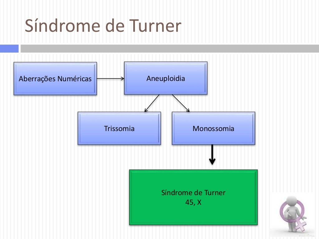 Síndrome de Turner