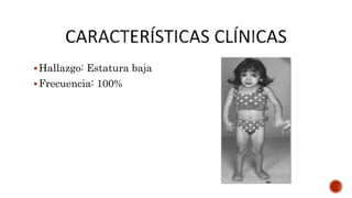 Hallazgo: Estatura baja
Frecuencia: 100%
 