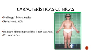 Hallazgo: Tórax Ancho
Frecuencia: 80%
 Hallazgo: Mamas hipoplasicas y muy separadas
 Frecuencia: 80%
 