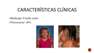 Hallazgo: Cuello corto
Frecuencia: 40%
 