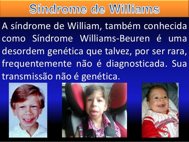Caracteristicas De Sindrome Williams