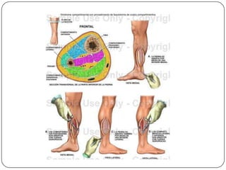 TratamentoEvitar analgésicos que possam mascarar a dorManter a extremidade na altura do coração , não sendo recomendável elevá-la ou abaixá-la.A elevação juntamente com o uso de anticoagulente está indicada quando é feito o diagnóstico de outra condição: a phlegmasiacelureadolens . Por isso diagnóstico diferencia é importante e pode ser necessário a avaliação do cirurgião vascular.