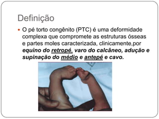 Enfaixamentos apertados 