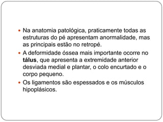 Uso prolongado do garrote operatórioPé torto congênito