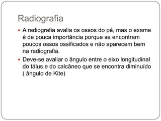 14 falanges (três para cada um dos dedos, exceto para o hálux, que tem apenas duas).DefiniçãoO pé torto congênito (PTC) é uma deformidade complexa que compromete as estruturas ósseas e partes moles caracterizada, clinicamente,por equino do retropé,varo do calcâneo, adução e supinação do médio e antepé e cavo.