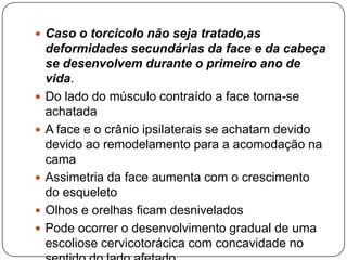 Torcicolo muscular congênito