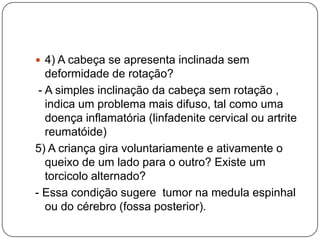 Deformidade mais comum nas meninasLado direito envolvido em 75% dos casosUma em cada 5 crianças (20%) com torcicolo muscular congênito desenvolve displasia do quadril.A condição não é genética sendo comum a ausência de história familiar.