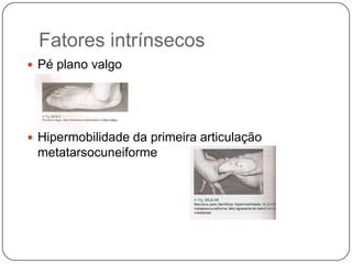 Exame FísicoDeverá se metódico e completoNÃO COMECE O EXAME TORCENDO OU ESTICANDO O PESCOÇO. Hiperextensão do joelho e quadril é anormal  sugestivo de displasia do quadrilReexamine os quadris das crianças Portadoras de torcicolo muscular congênito na sexta semana, aos 3 e 6 meses e com 1 ano para descartar qualquer luxação ou subluxação do desenvolvimento pós natal