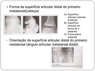 ExercícioAplique contração segurando o ombro ipsilateral e o peito com uma das mãos e inclinando a cabeça lateralmente com a outra para longe do músculo contraídoMantenha o músculo esticado e conte até 10Os exercícios devem ser executados de 20 a 30 vezes em cada sessão , quatro a seis vezes ao dia 