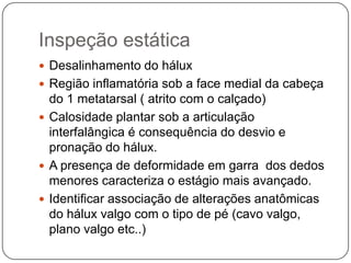 A morfologia do háluxvalgo evidencia o desvio medial do primeiro metatarsal, a saliência interna da articulação metatarsofalângica e o desvio lateral do primeiro dedo.