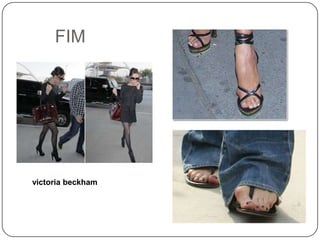 Quadro clínicoValorizar a presença de dorAcometimento da funçãoGrau do desvio do alinhamentoOs sinais e sintomas são explicitados em uma escala numérica elaborada por Kitaoka e colaboradores.Anamnese : antecedentes familiares,avaliação detalhada em relação a dor, questionamentos sobre limitações da atividades,desconforto com realação ao tipo de calçado etc...Dor geralmente relatada na face interna da articulação metatarsofalângica do hálux que se intensifica com a deambulação e com utilização de calçados inadequados.