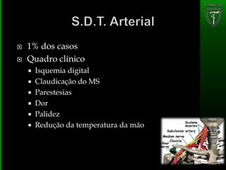  1% dos casos
 Quadro clínico
 Isquemia digital
 Claudicação do MS
 Parestesias
 Dor
 Palidez
 Redução da temperatura da mão
 